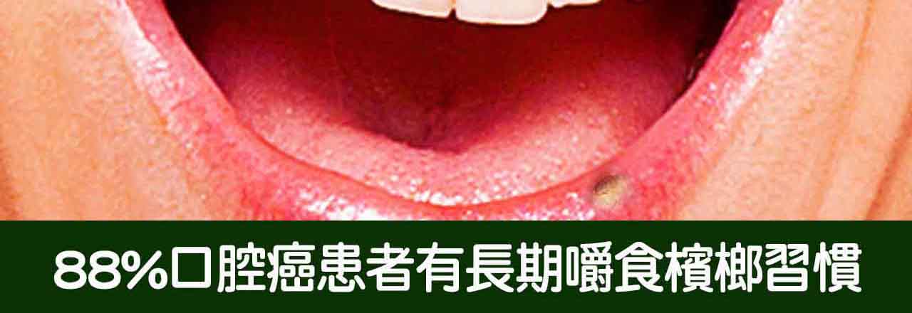 中醫口腔癌治療