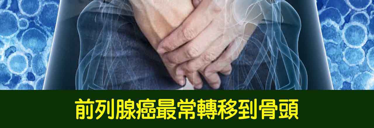 中醫攝護腺癌、前列腺癌治療