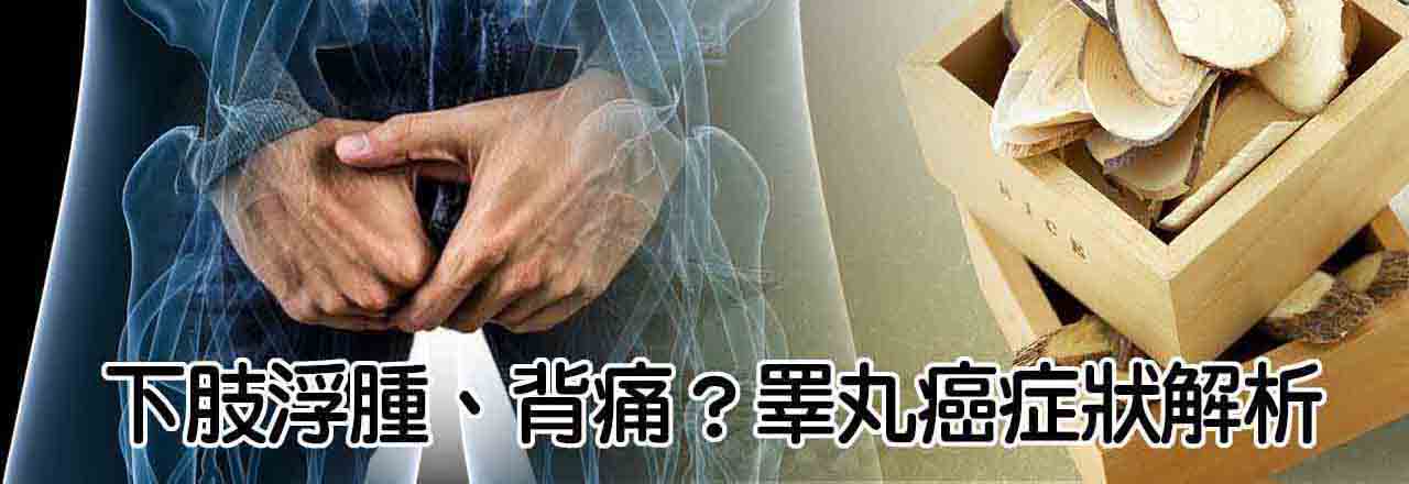 中醫睪丸癌治療