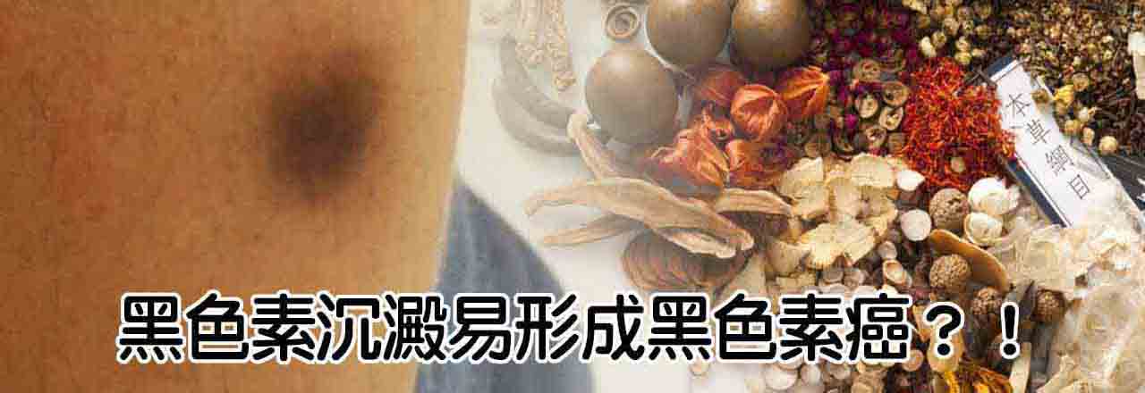 中醫黑色素癌治療