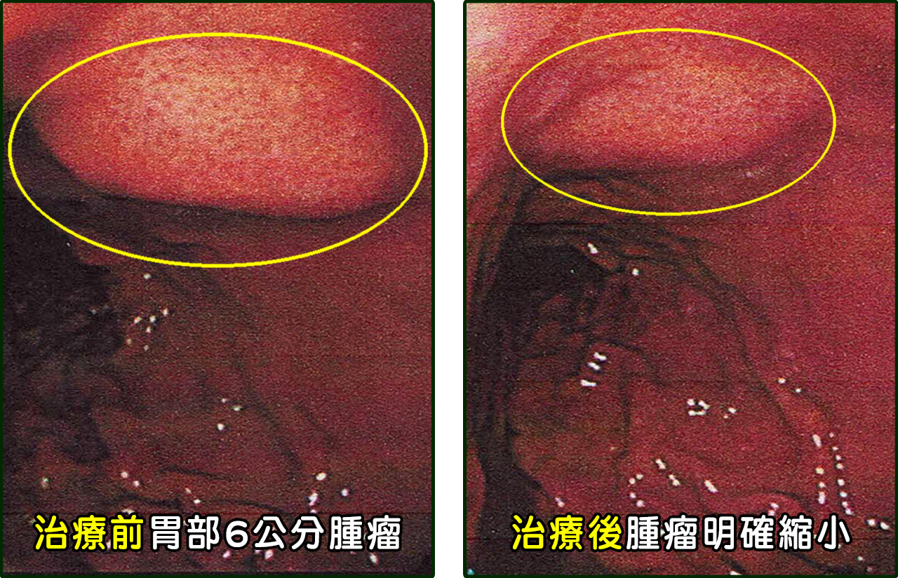 老花眼、視網膜病變、黃斑部病變、眼中風