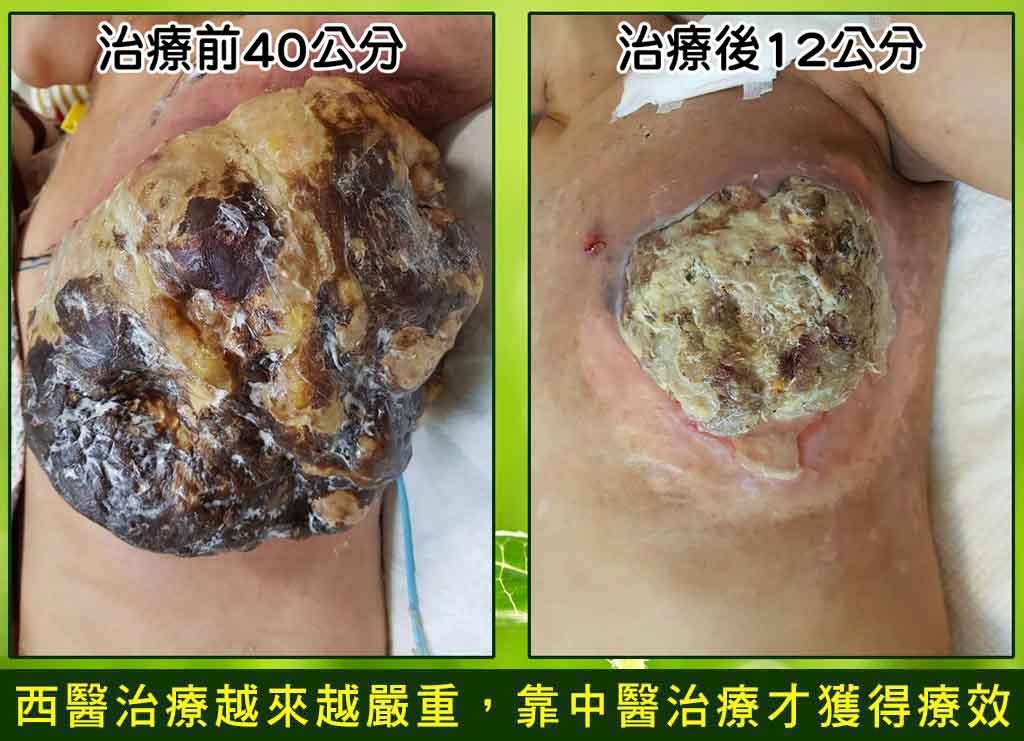 飛蚊症、乾眼症、角膜炎、結膜炎治療