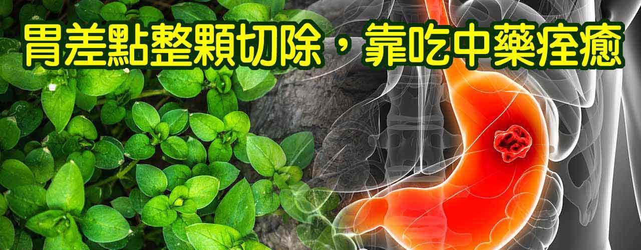 胃癌治療_初次罹患癌症腫瘤治療案例-10