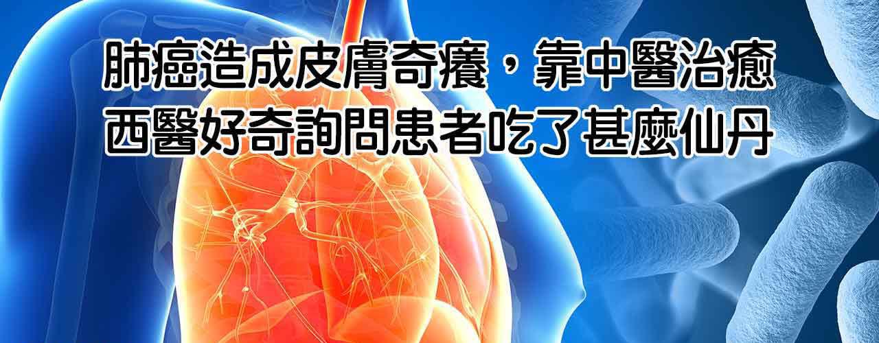 肺癌治療_初次罹患癌症腫瘤治療案例-5