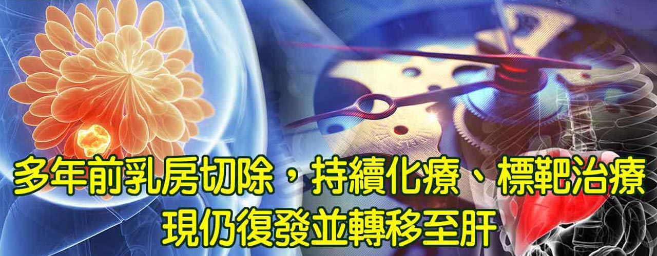 中醫乳癌轉肝癌治療_腫瘤癌症復發轉移治療案例-8