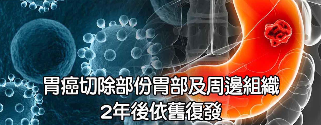 中醫胃癌復發治療_腫瘤癌症復發轉移治療案例-9